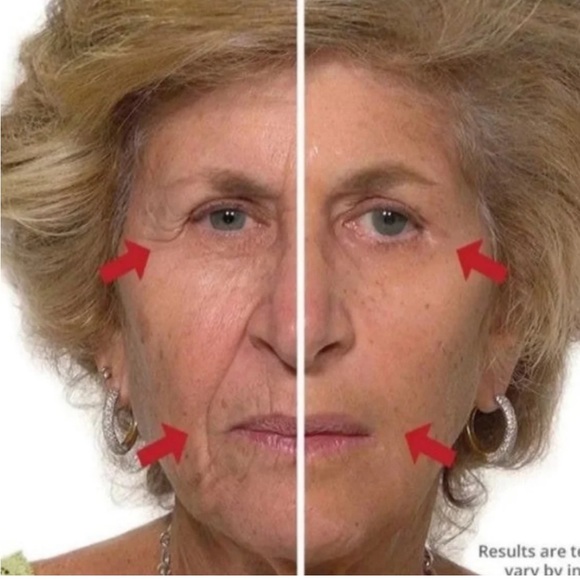 ⚜️Plexaderm Skin Care Rapid Reduction Serum! - Picture 5 of 8